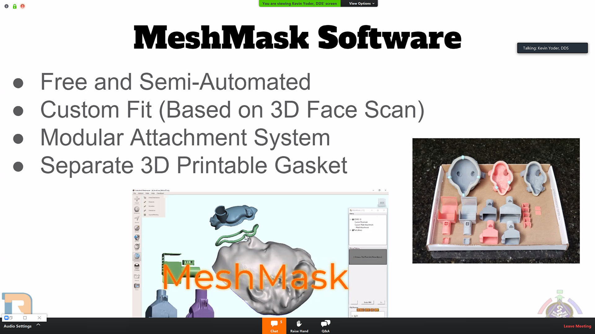 Dr. Kevin Yoder, DDS created the MeshMask software, free of charge and available at d3Tool.com.
