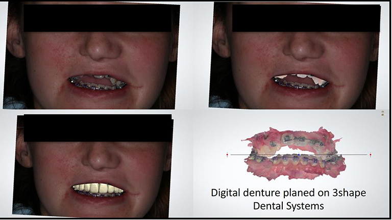 UofM Dental Lead 768x432.jpg