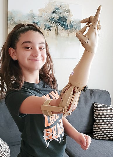 Unlimited Tomorrow Delivers Personalized Prosthetic Arms